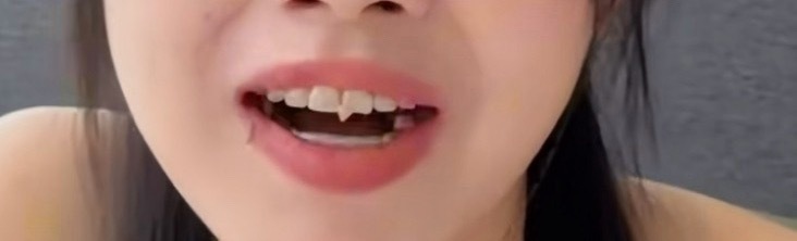 我真的眼前一黑，一牙缝的菜，胡杨林也拍。这牙缝的菜都能煮一餐饭 。以后他牙缝开蜜