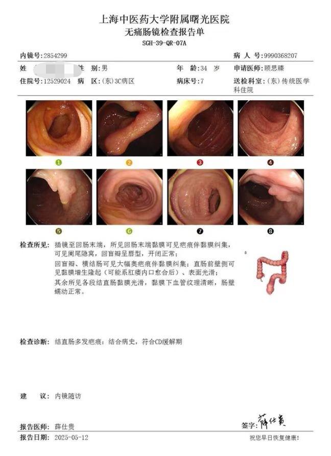 感谢我的克罗恩病患者的馈赠和认可！ 炎症性肠病治疗会的“铁三角”定律 ...