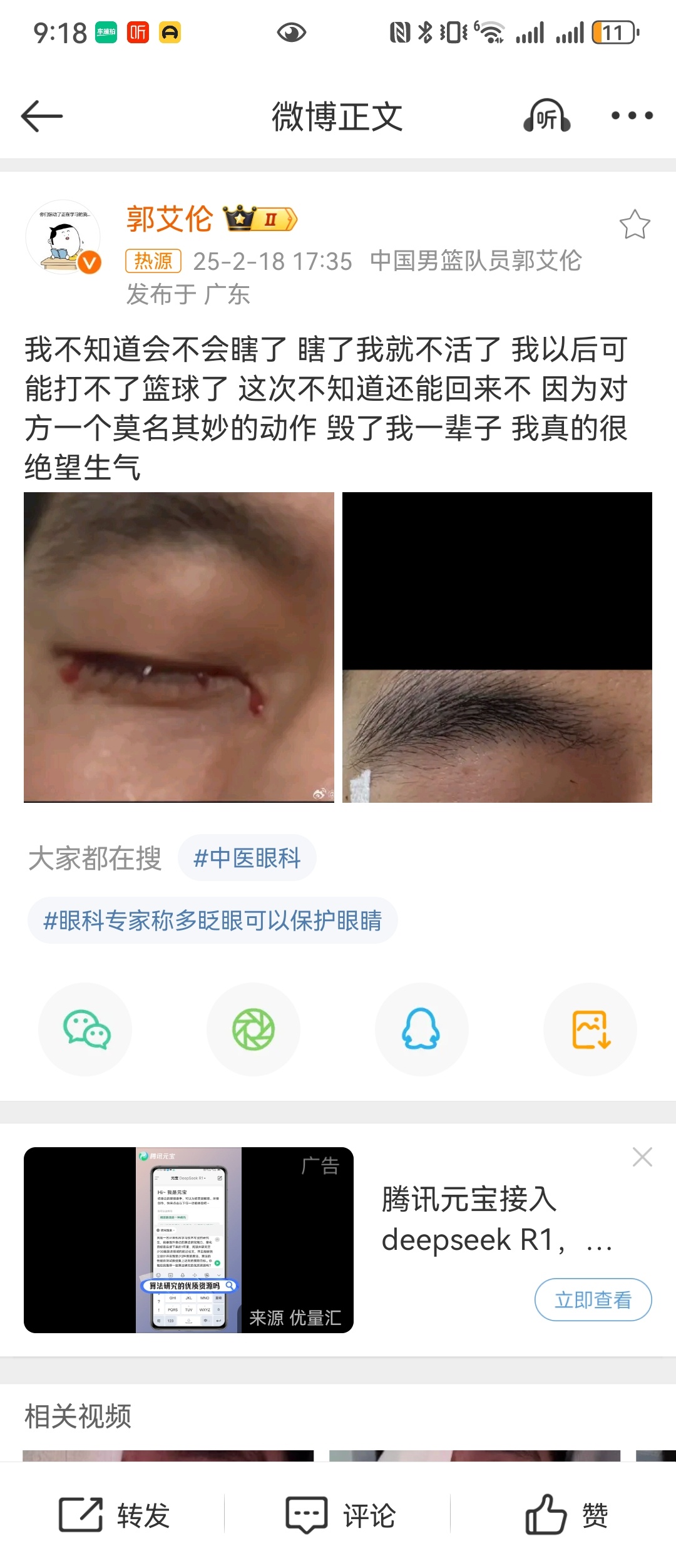 郭艾伦 以后可能打不了篮球了  感觉艾伦这几年也挺不顺的，运动员的巅峰时期真的没