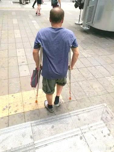 只有经历过才知道别人的苦
这大哥这是为下一位骨折患者准备的
值得大家学习此种行为