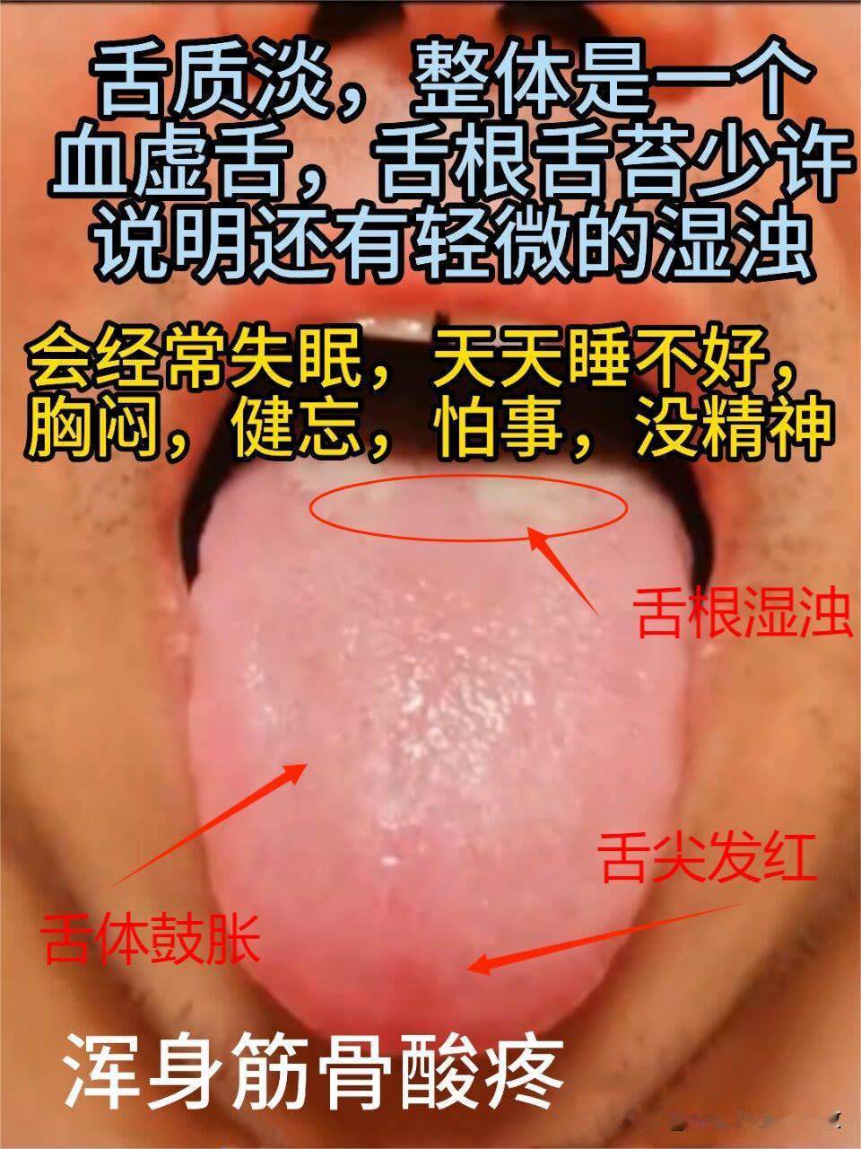 黑眼圈那么大，一到晚上就心烦[吃瓜群众][吃瓜群众]
翻来翻去你就是睡不着
分享