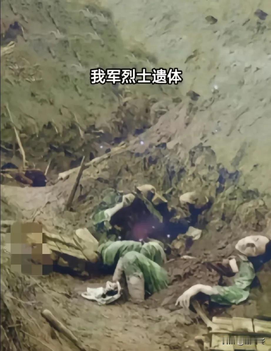 老山前线，战壕里身体半埋于泥土的烈士遗体！
年轻的战士不慎牺牲在越军的炮火下，他