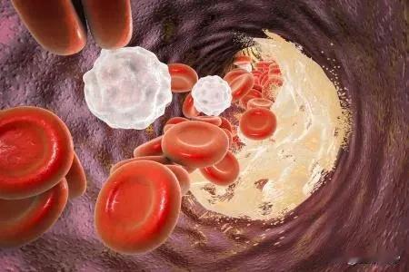 少吃蛋白质，尤其这种，高蛋白饮食或促进心血管疾病

随着现代生活节奏的加快，人们