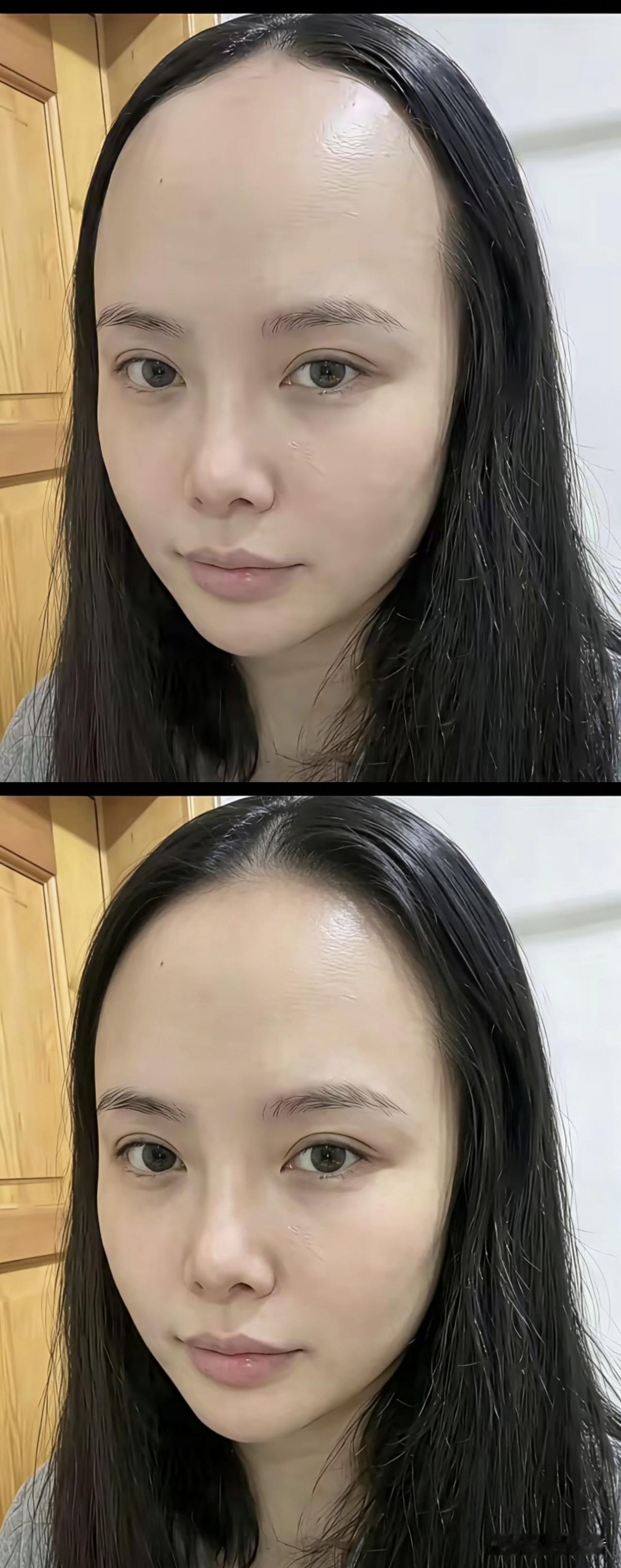 发型设计不好，五官再精致看起来也不漂亮。上图是发际线后移美女的图片，下图是帮美女