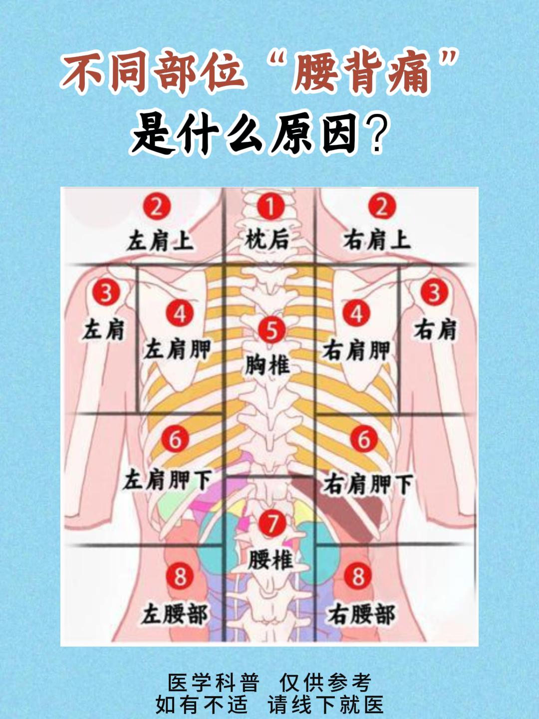 不同部位腰背痛是什么原因。