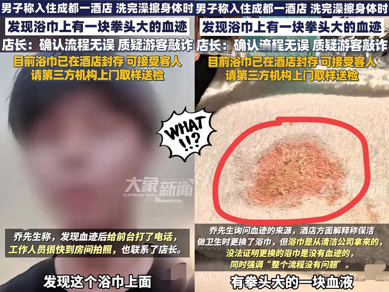 成都一男子男住酒店，
洗完澡刚要拿毛巾擦身，
直接吓出一身冷汗！结果

毛巾上拳