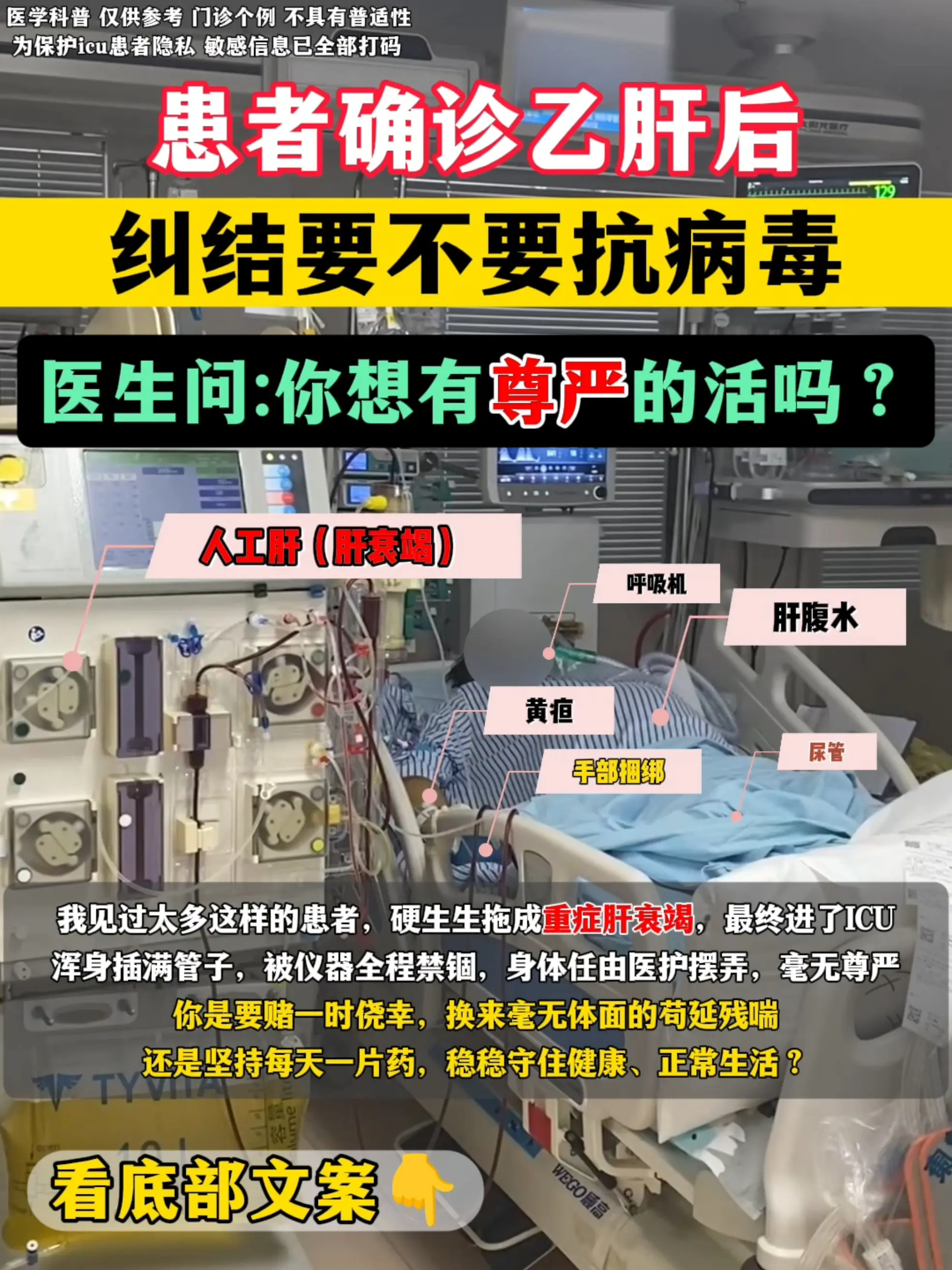 我见过太多这样的患者，硬生生拖成重症肝衰竭，最终进了ICU，浑身插满管...