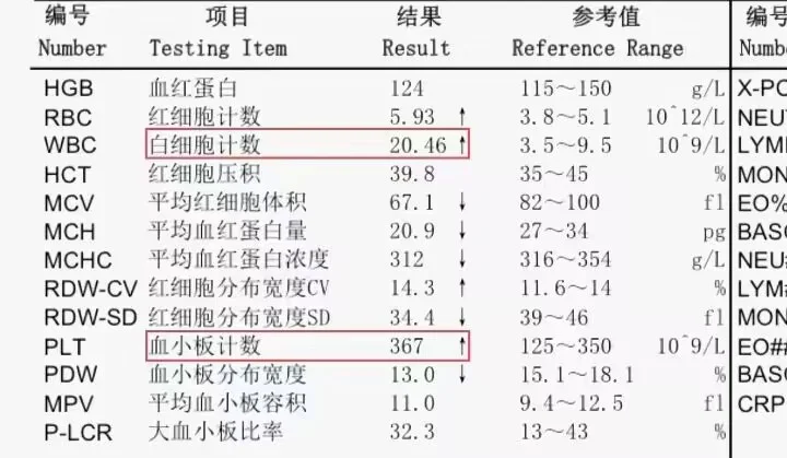 血常规这俩个高