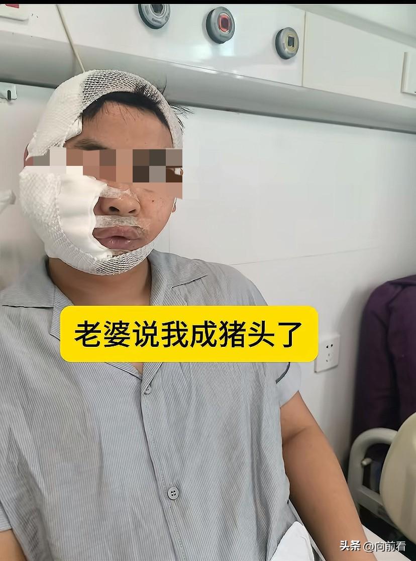 男子花480元体验潜水，没想到被3米长的“大鲨鱼”咬伤头和脸，景区却只愿赔偿2万