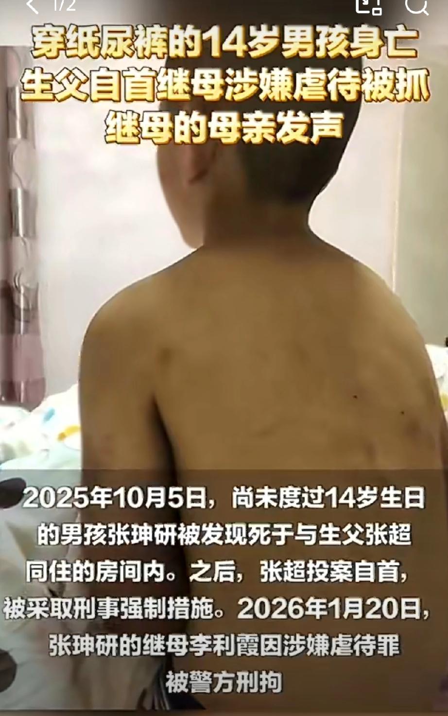 河南14岁少年被虐待去世，
最让人心痛的不是施暴者是他的亲生父亲，

而是长达五