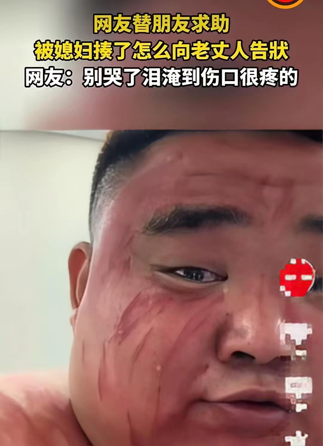 湖北一名男子被媳妇打了，躲到朋友家越想越委屈，决定去找老丈人评理。结果他在朋友家