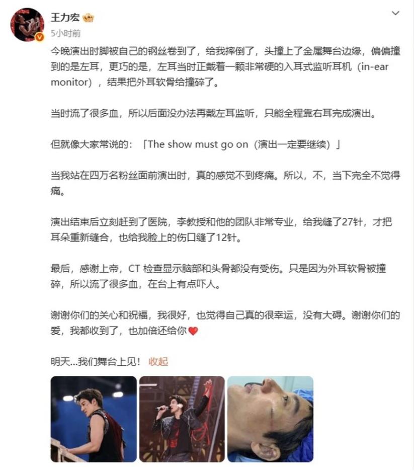 50岁王力宏摔碎外耳软骨，缝了39针后说“明天舞台见”：成年人的世界，哪有容易二