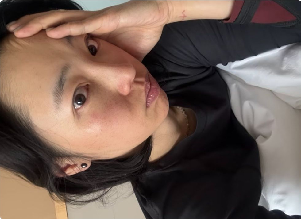 白百何晒出“高原红”，素颜脸颊泛红有斑点，已紧急回家休息 