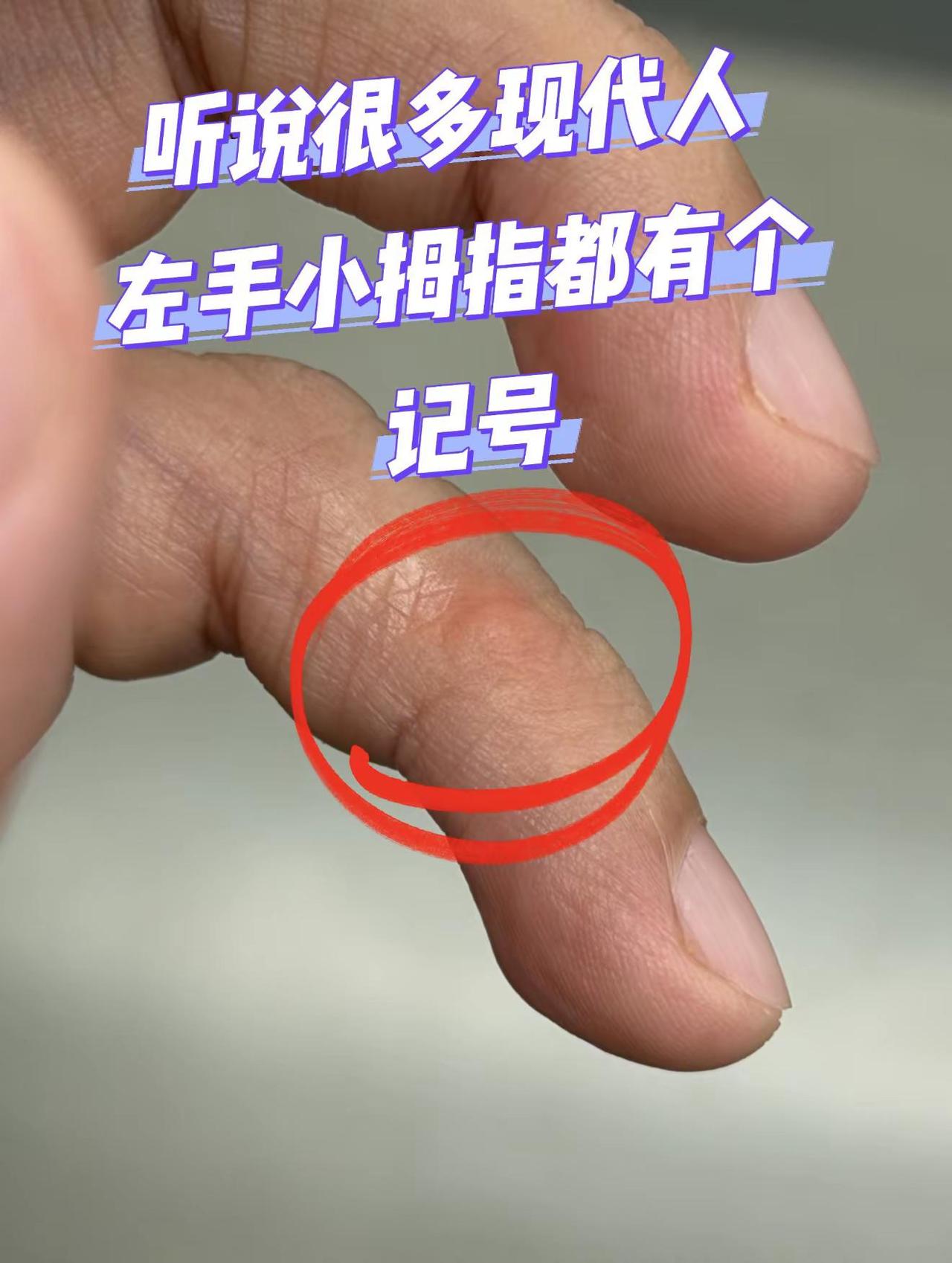 听说很多现代人左手都有个神秘记号。你有吗？