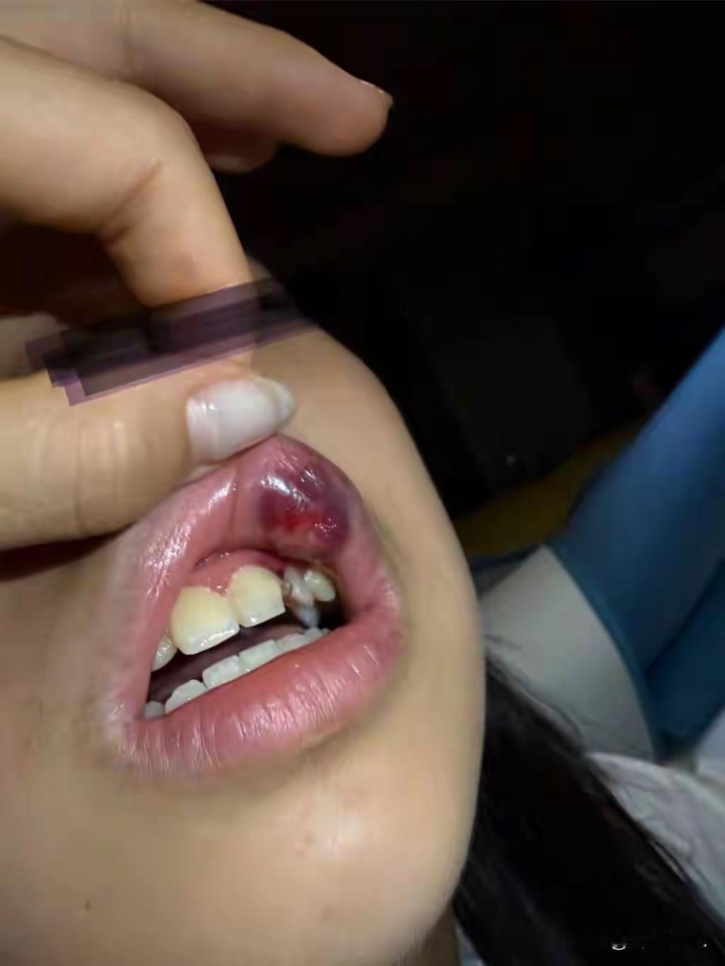 “天生坏种！”台湾，15岁女生，从初一到初三，长达3年的时间里，被同班一比其重2