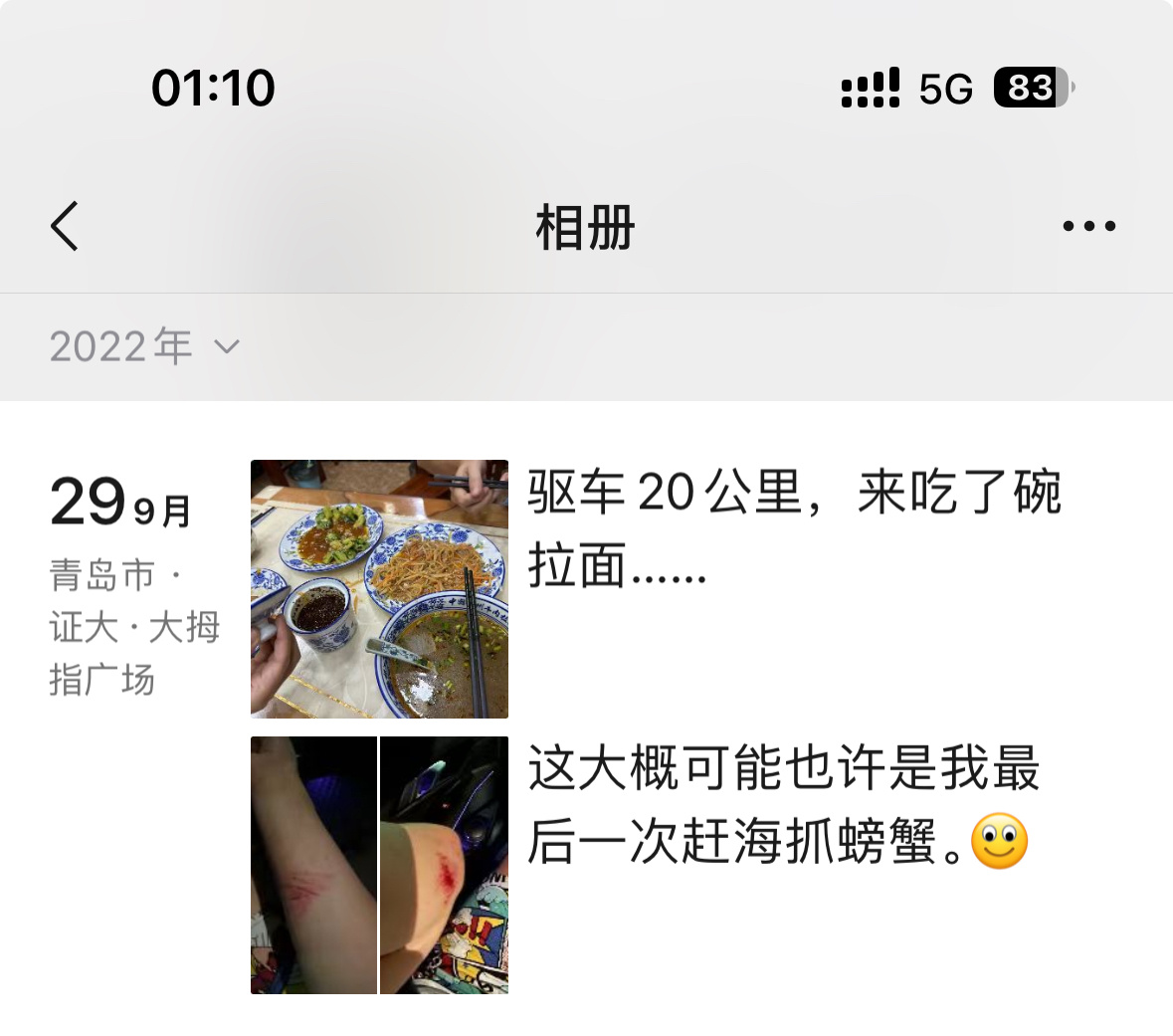 两年前抓螃蟹，摔倒了。今天来抓螃蟹，滑倒了……缝了三针，太离谱了真是……  ​​
