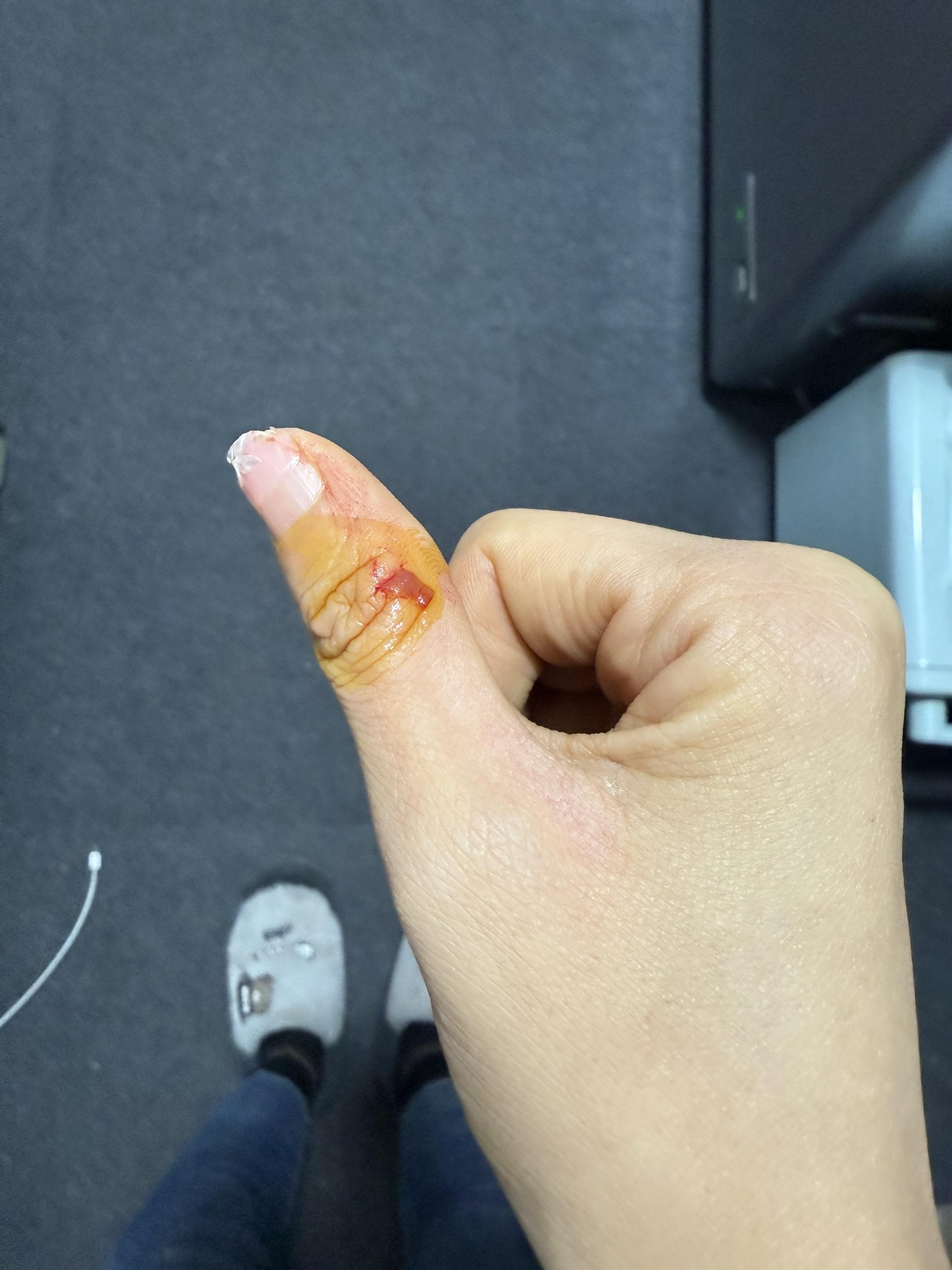 今年我这个手指跟我遭老罪了，切菜切指甲上，这又掉块皮……🫠