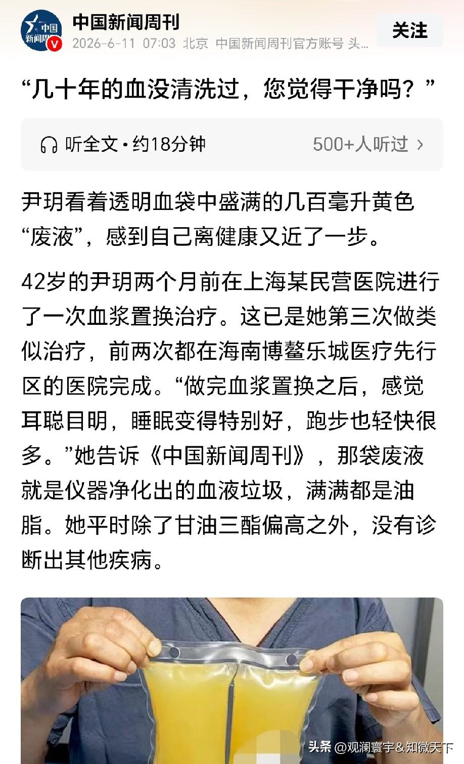 怕的是机器清洗不严、污染、感染(细菌、病毒)，实际应用中可能存在极低水平的微生物