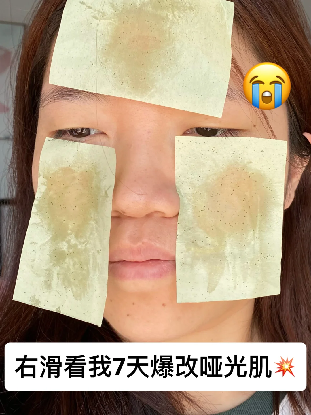 右滑👉看我7天大油皮爆改清爽哑光脸！！