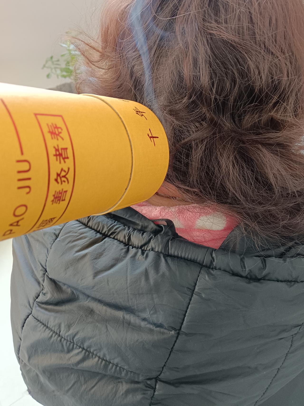 头痛，不用针不用药，单纯大炮灸20分钟疼痛解除，大家说说我需要收多少钱合适？