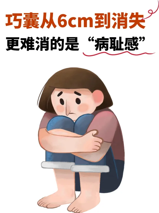 比巧囊更难消的，是“病耻感”，你也是吗？