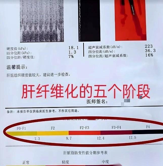 体检报告拿到手，一堆箭头和数据，很多人直接翻到最后一页看“总结”。
但有个数字，