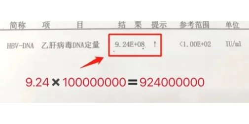 乙肝严不严重，就看这3点！