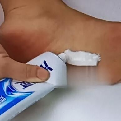 睡前把牙膏涂脚底，这操作听起来离谱但作用还真不少。夏天脚爱出汗，脚臭问题让人头大