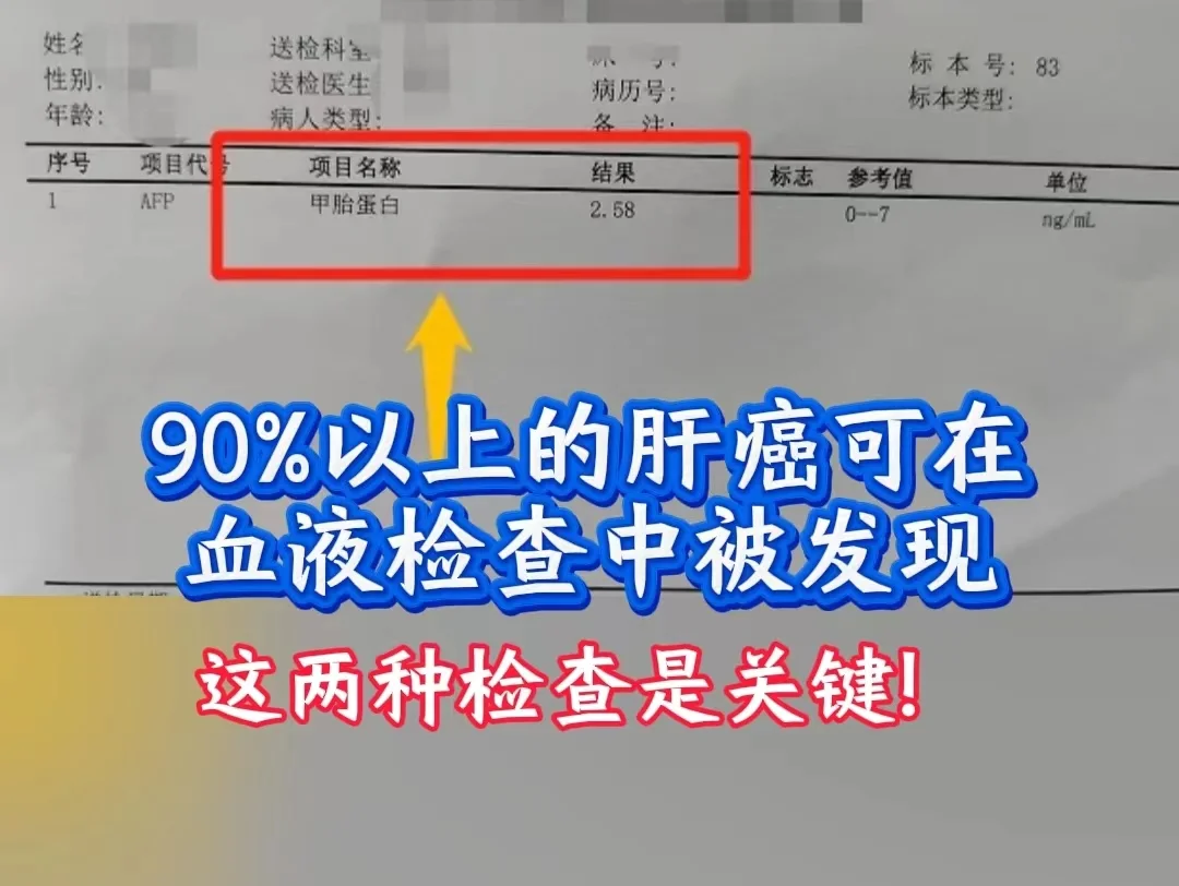 90%的肝癌都能在血液里看出苗头！但太多人白白错过了最佳时机…​ 作为...