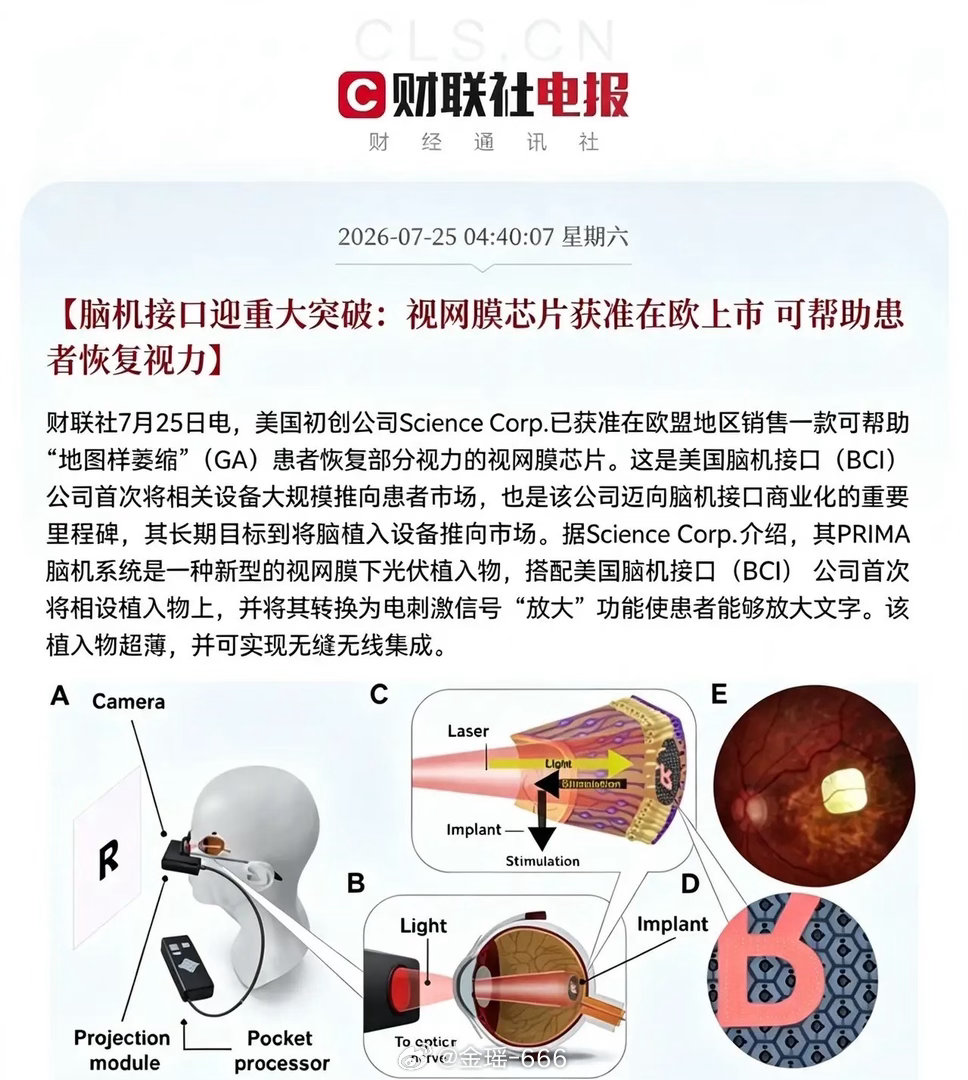 重磅大瓜！脑机接口迎来历史性突破！下周新主线定了？重磅突发！凌晨全球科技传来超级