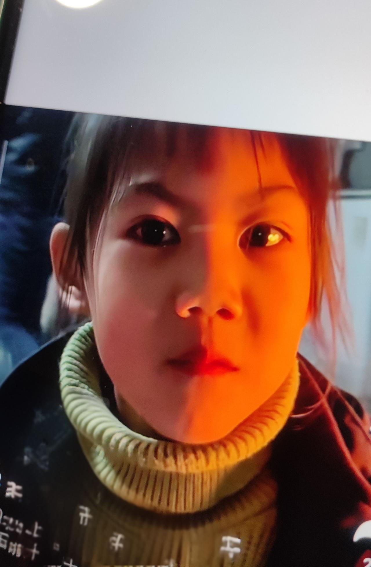 摊上事儿了！河南9岁女孩张芯瑞在省人民医院进行喉部血管畸形手术，术后因缺氧变成了