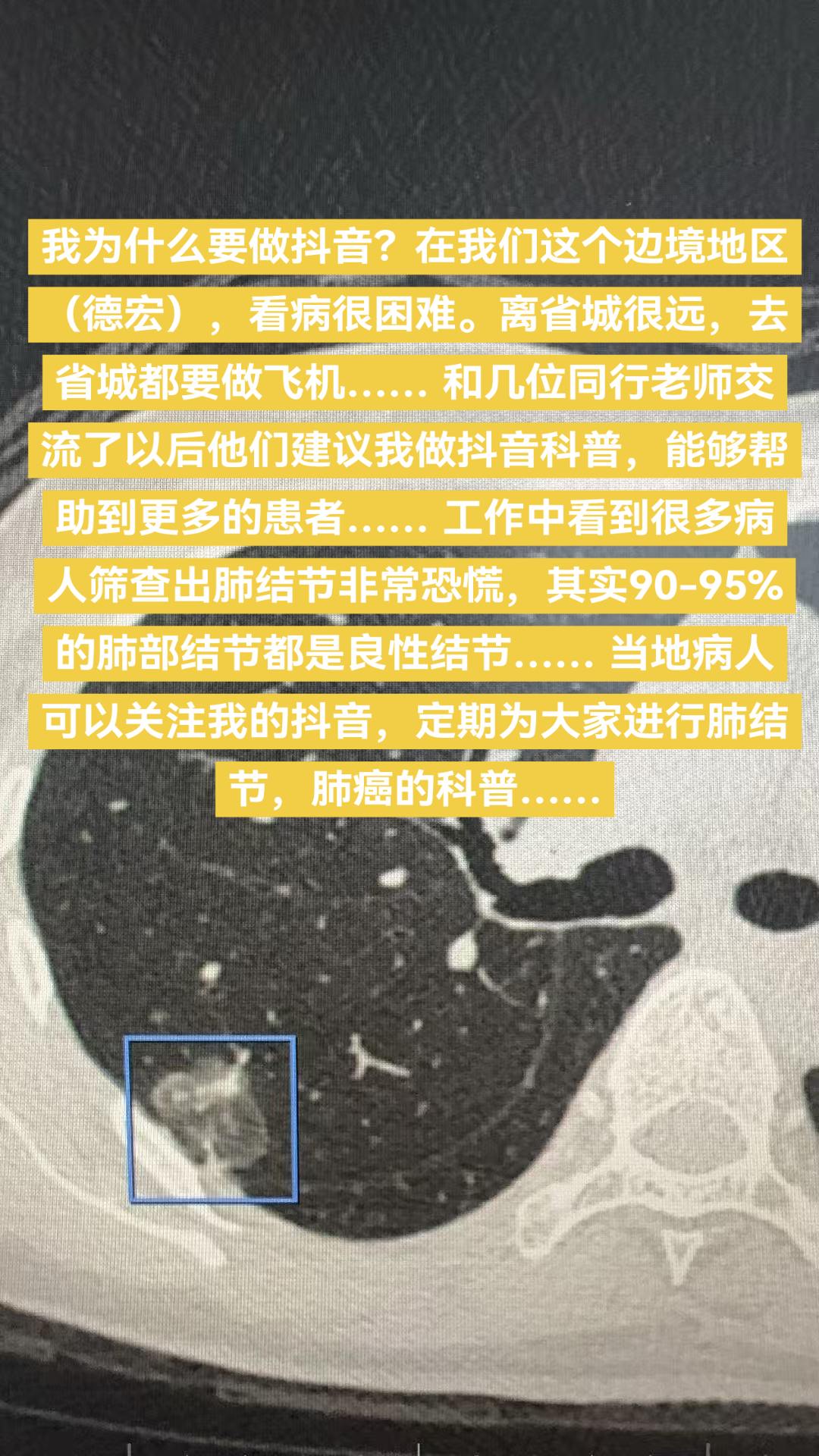 我为什么要做科普？我为什么要做科普？在我们这个边境地区（德宏），看病很...
