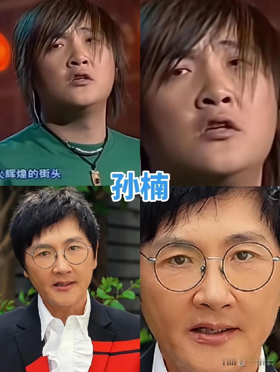 现在的孙楠变锥子脸，瘦下来的孙楠和以前判若两人。看来减肥只有意志坚定，没有什么不