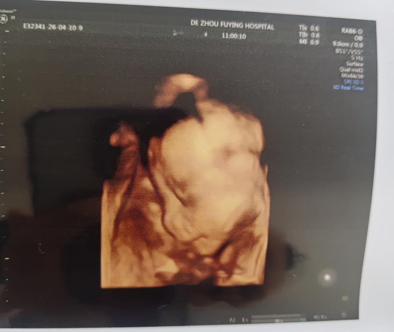 昨天陪儿媳妇去德州做四维，亲家也不放心，专门打车过来。
我和儿媳妇说开车去接她，