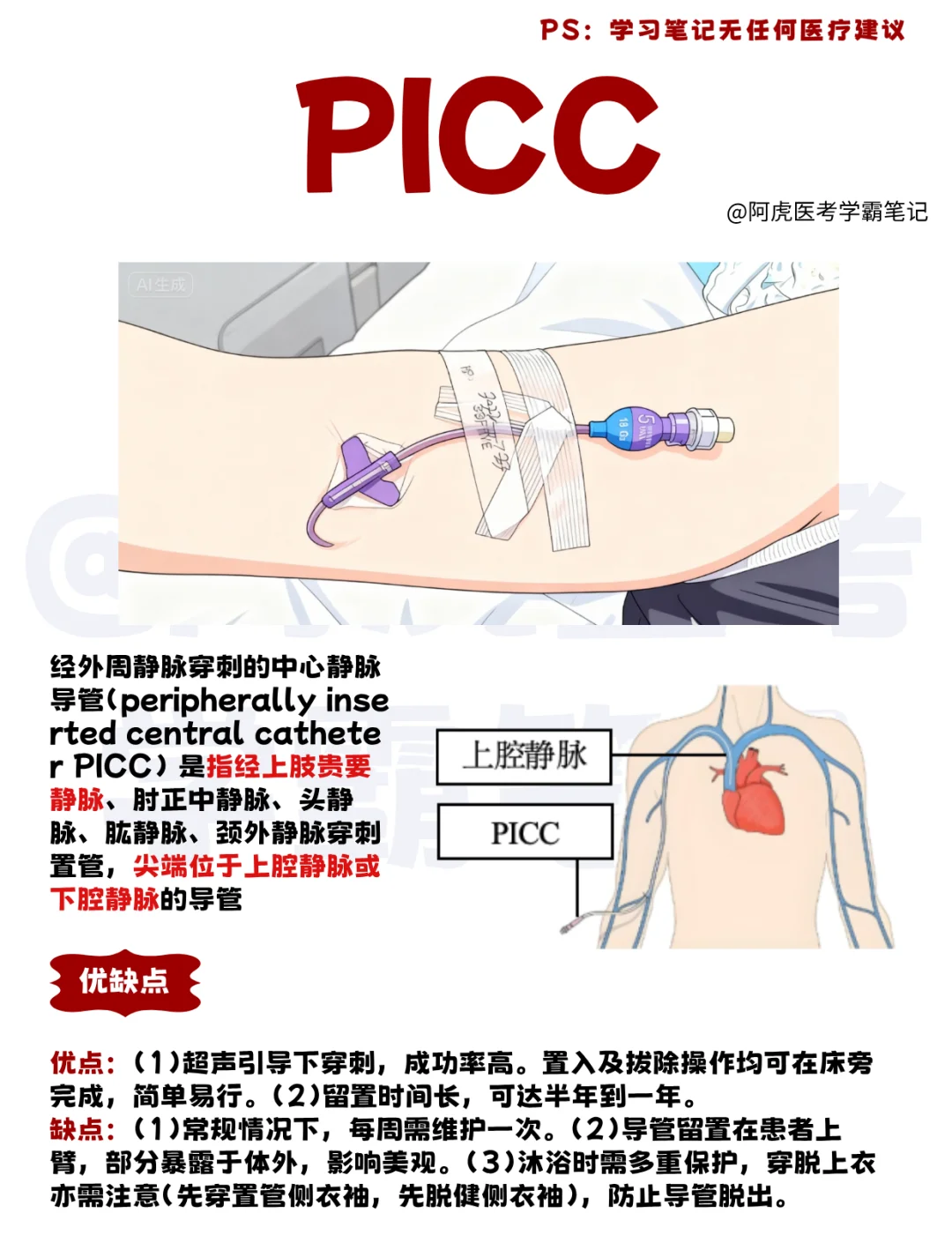 医学生笔记📒：外周静脉置入中心静脉导管