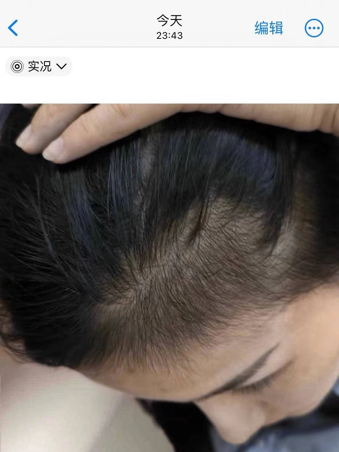 WOC啥原理？都去买啊啊啊啊啊（秃头）