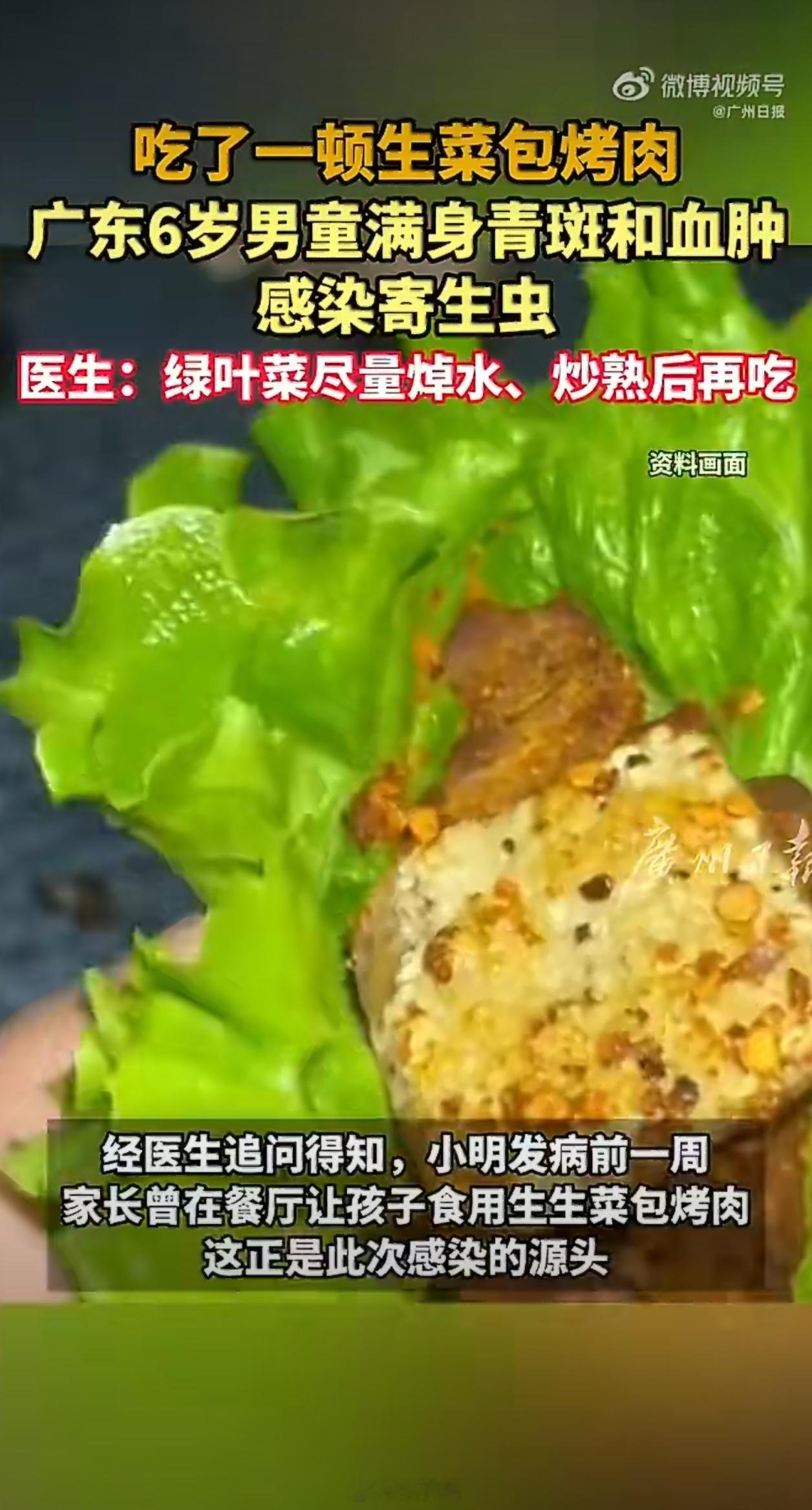 6岁男童吃生菜后血肿感染寄生虫麦当劳跟KFC的生菜总能生吃吧