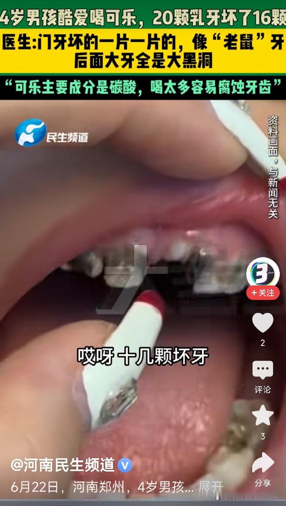 这新闻看的我是又气又心疼

郑州一个4岁小男孩，被妈妈带到医院看牙。

孩子一张