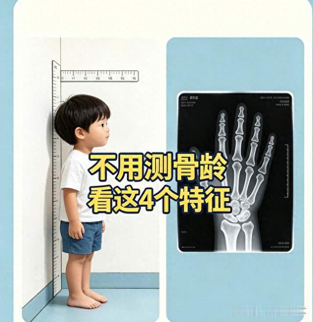 孩子还有多少长高潜力？不用跑医院测骨龄，看这4个特征