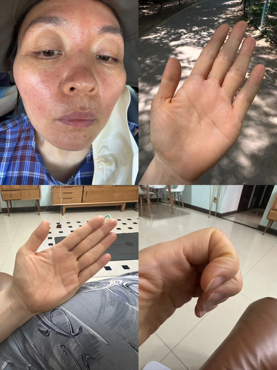 突然过敏啦！直播需要暂停几天啦！