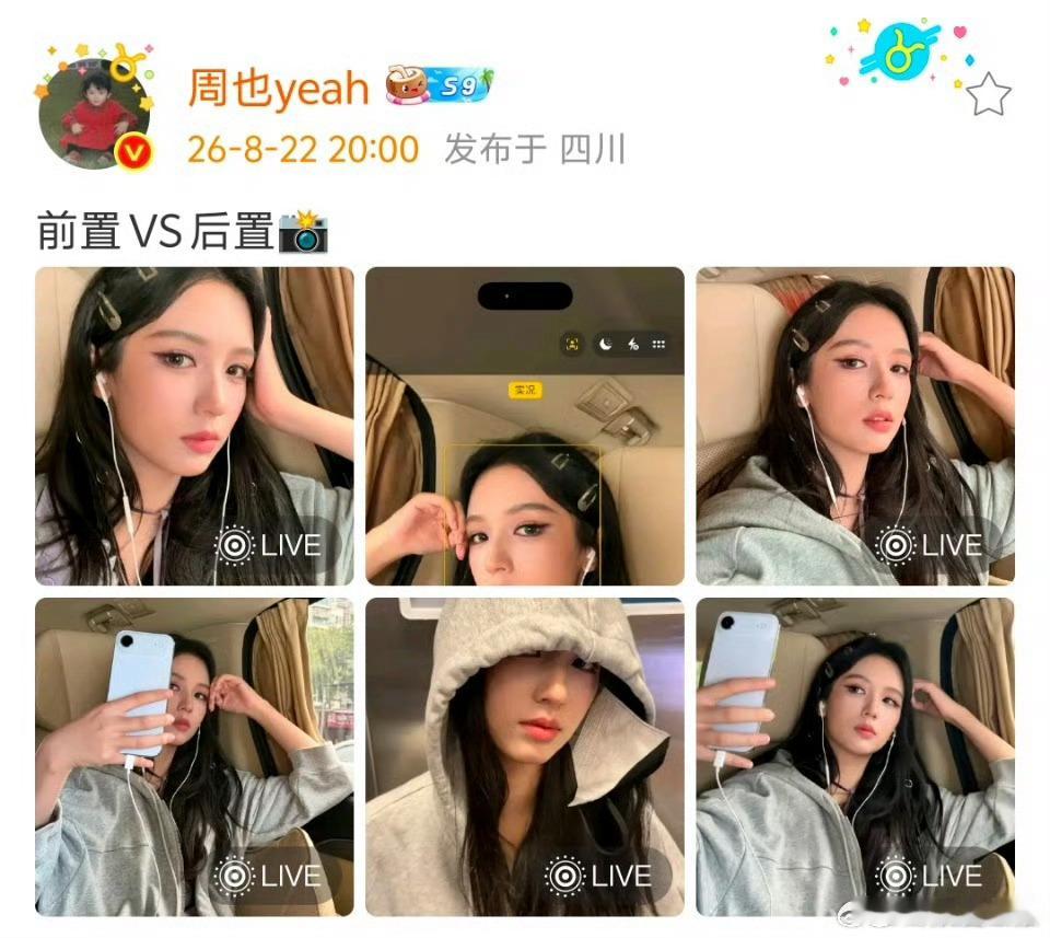 周也前置vs后置 看了周也的前置后置，我才知道什么叫“美得很轻松”！这优越的骨相