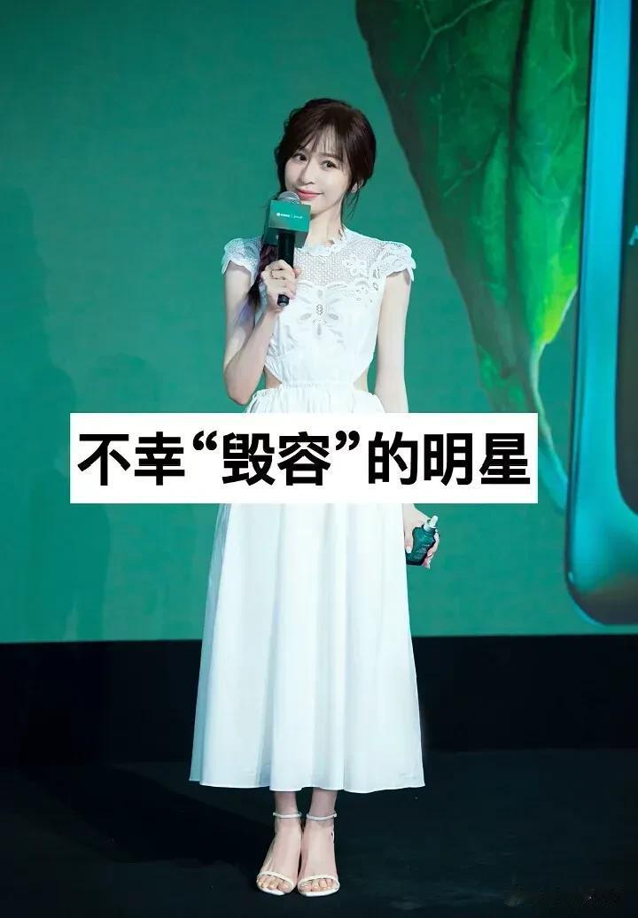 不幸“毁容”的明星