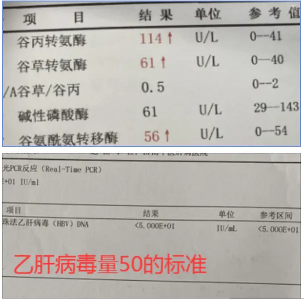 吃抗病毒药还肝硬化，这1点很多人都做错了。聊城患者目前用药1年多了，从...