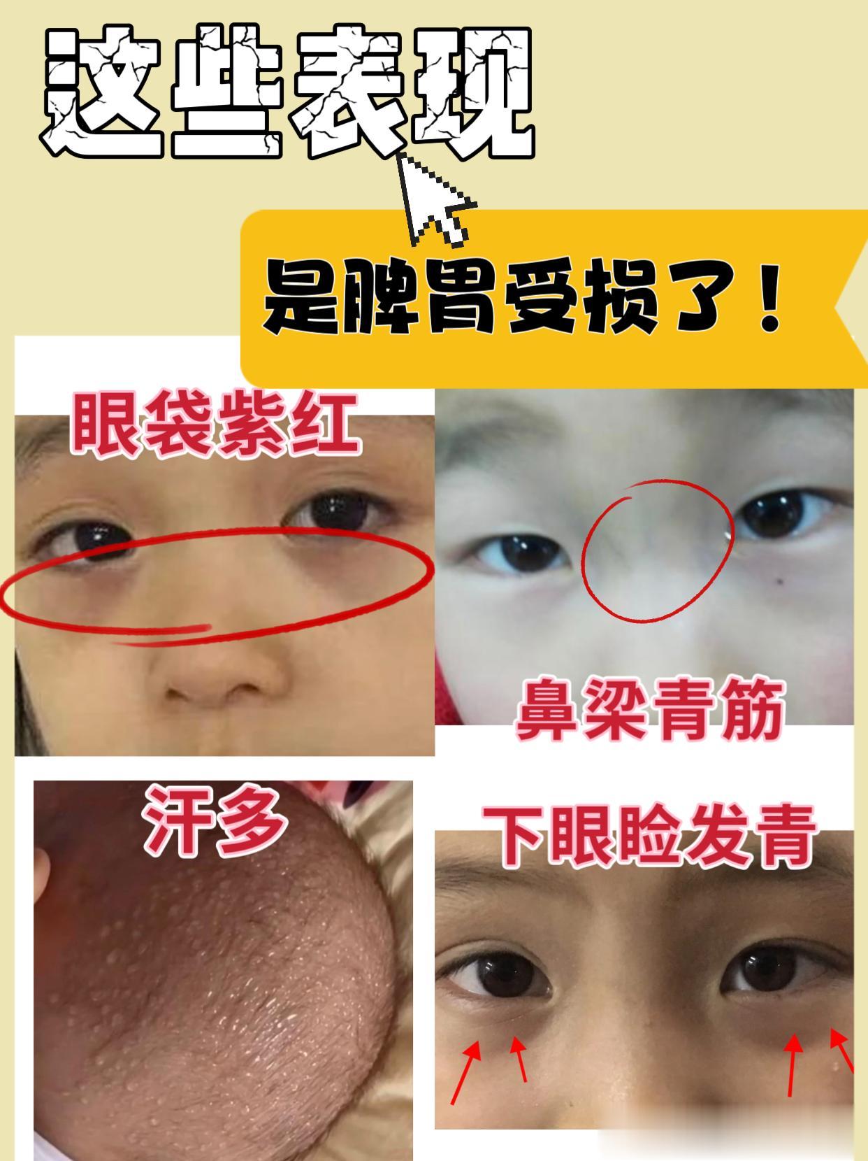 脾胃好了，孩子1年追高12cm，比生长js简单！
 
孩子身高最佳干预时期是幼儿