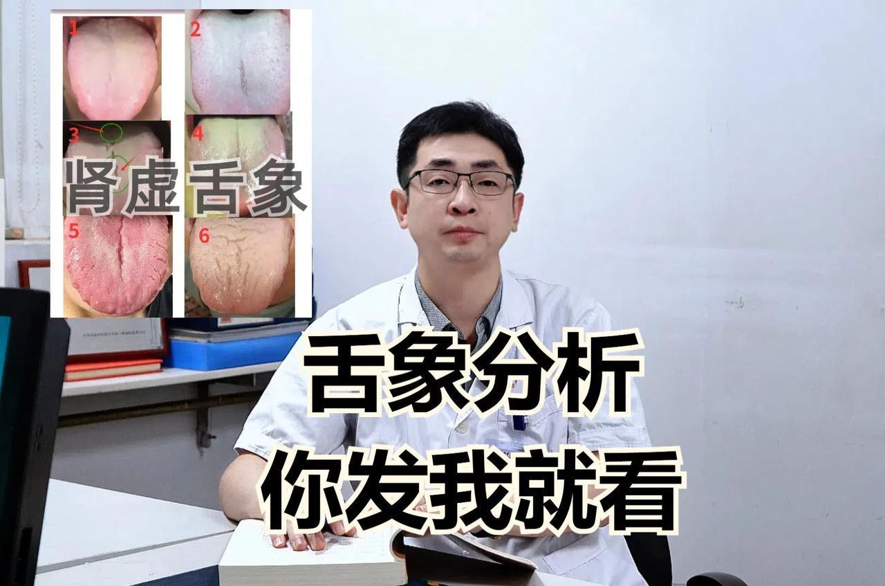 本月舌诊挑战第12天！——今天看完100个舌头！

拍舌头照片还是老规矩：

1