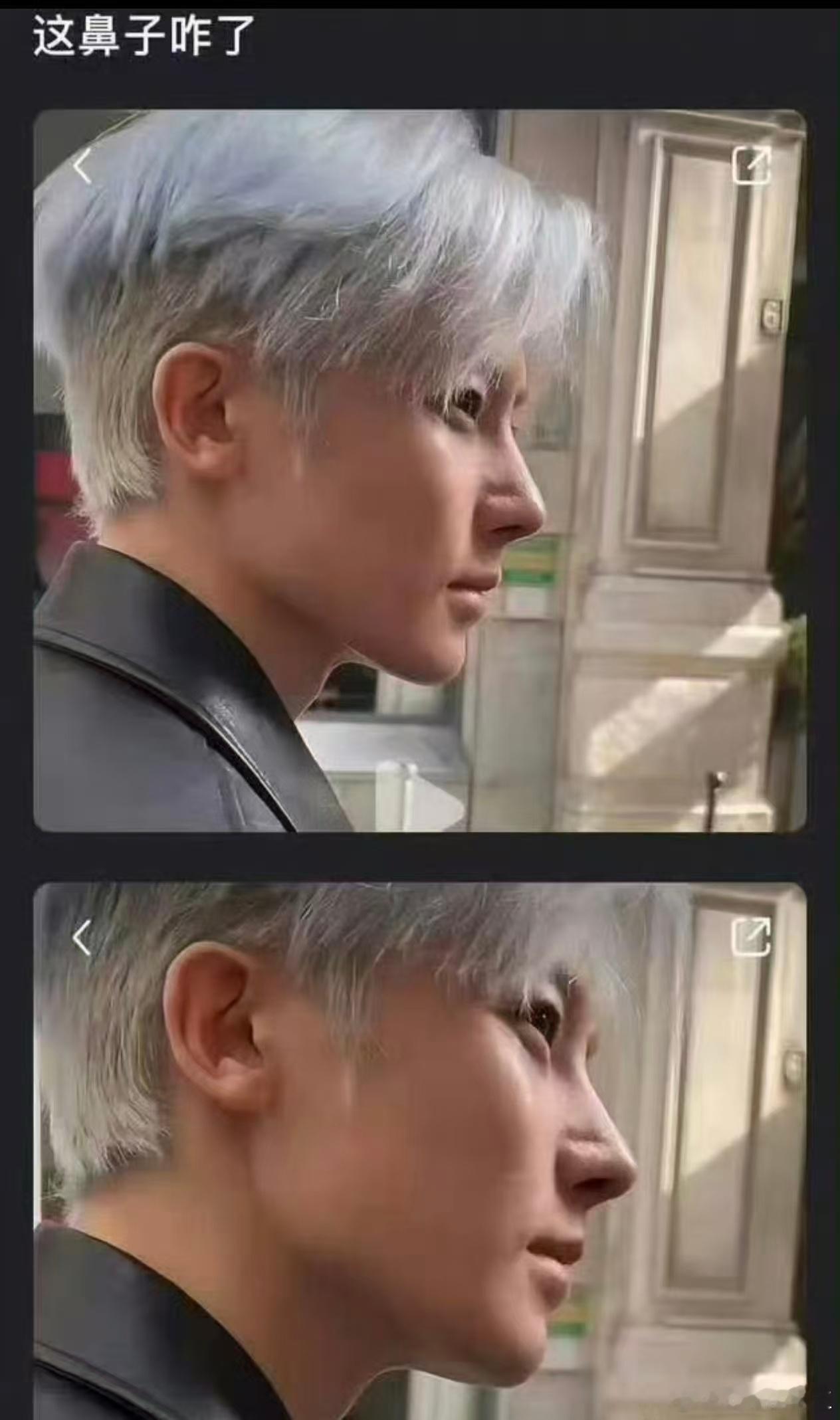 侯明昊鼻子怎么了？ 侯明昊卡点520发博