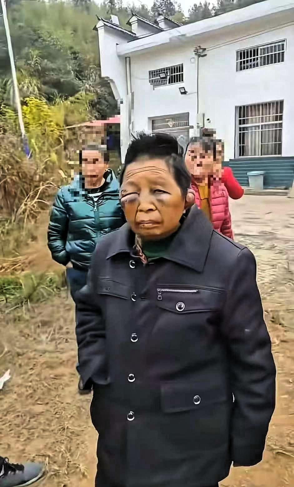 不敢想她才40多岁，生活已经将她摧残到60多岁的模样，娘家人都跑哪儿去了！

4