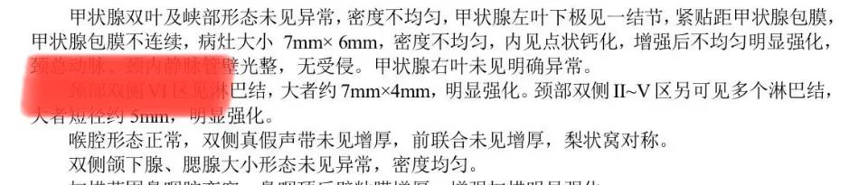 即便是甲状腺微小癌，不符合条件的，不可以观察，应该及早手术！日前，一个甲状腺专家