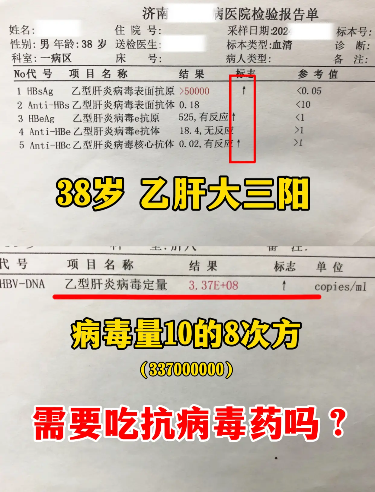 38岁的刘先生，乙肝大三阳，专门从德州特意赶来过来问我要不要抗病毒。当...