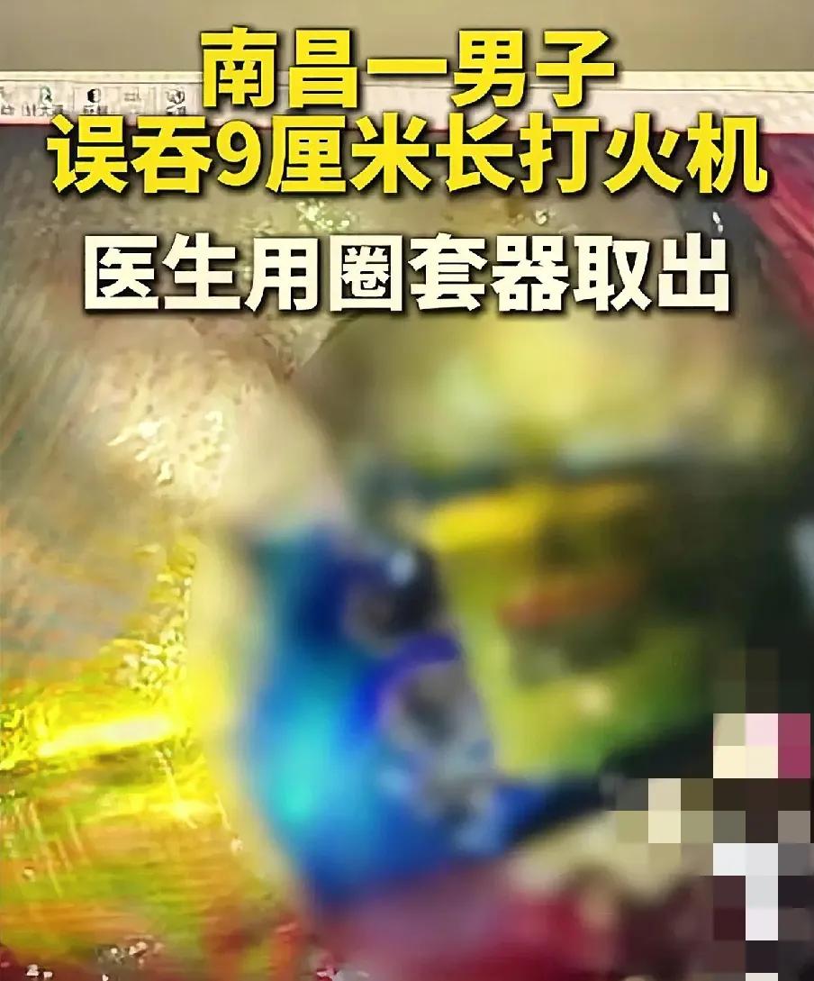 南昌男子误吞打火机，意外背后的安全隐忧
 
近日，南昌市中心医院迎来一位特殊病患